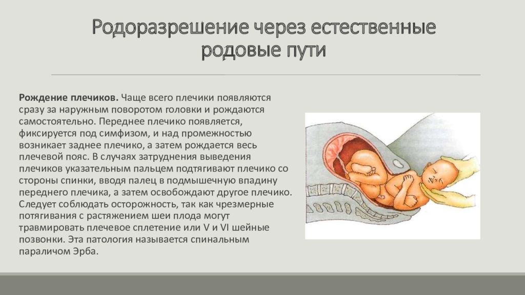 Обструктивные роды презентация