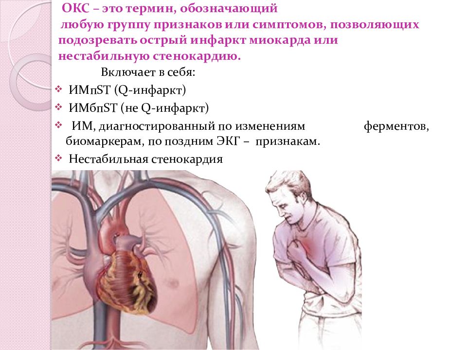 Острый коронарный синдром лекция