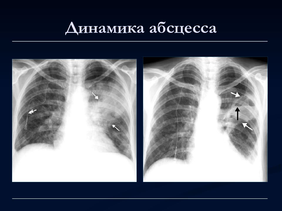 Лучевая диагностика органов дыхания презентация