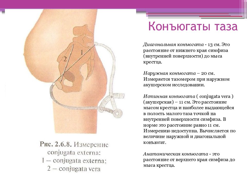 Акушерские размеры таза на рисунке