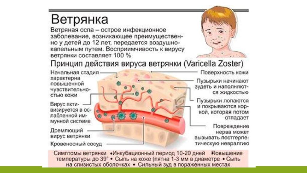 Ветрянка инкубационный период у детей заразность. Ветряная оспа инкубационный период у детей. Ветряная оспа у детей памятка. Ветрянка у детей информация для родителей симптомы. Ветряная оспа картинки.