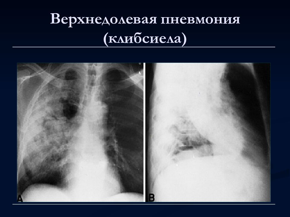 Лучевая диагностика органов средостения презентация