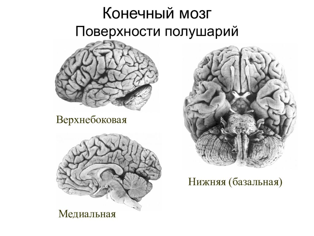 Конечный мозг. Базальная поверхность конечного мозга. Верхнебоковая поверхность мозга. Верхнебоковая поверхность полушарий. Конвекситальные медиальные и базальные.