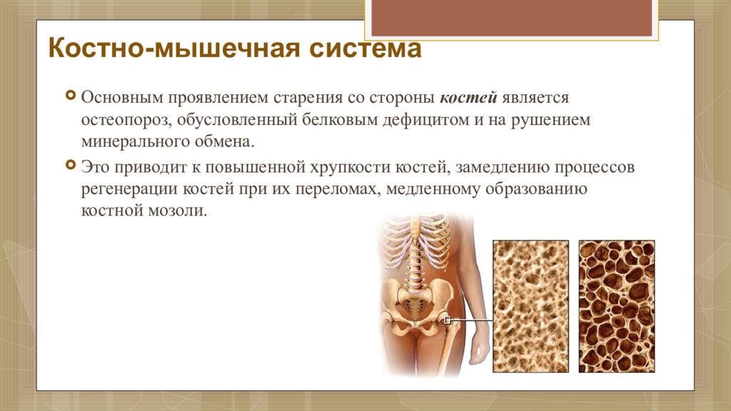 Признаком возрастных изменений костей является. Заболевания костно-мышечной системы. Старение костно мышечной системы. Старение костной системы. Возрастные изменения костно мышечной системы.