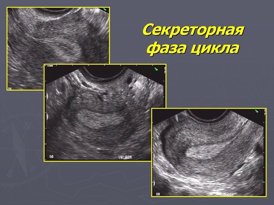 Узи в гинекологии презентация