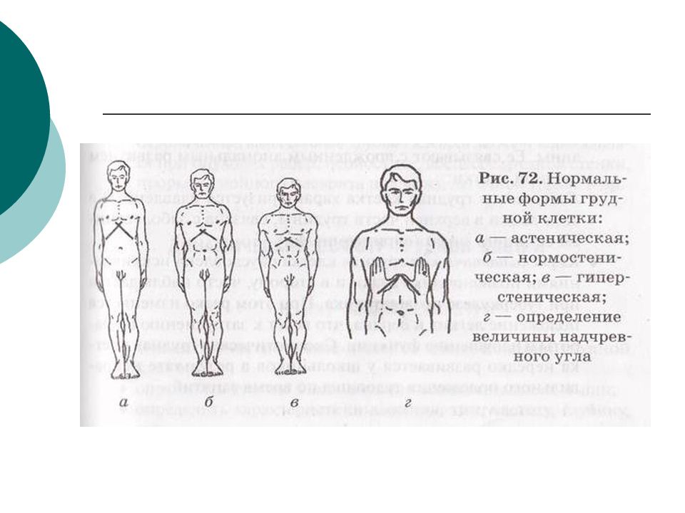 Патологические формы грудной клетки презентация