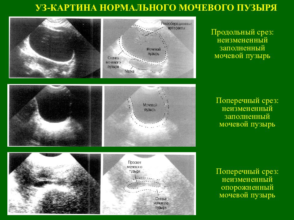 Ультразвуковое исследование презентация