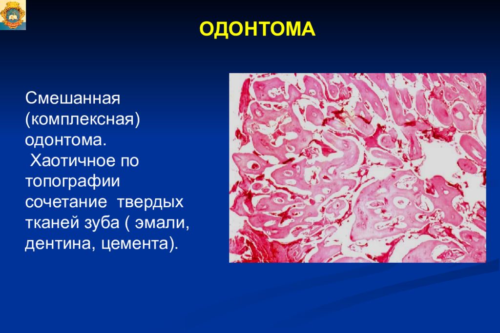 Опухоли опухолеподобные поражения и кисты кожи лица презентация