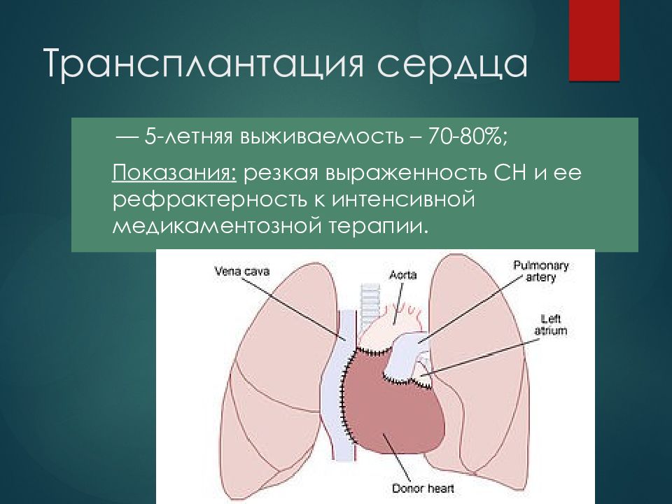 Стоимость Операции По Пересадке Сердца