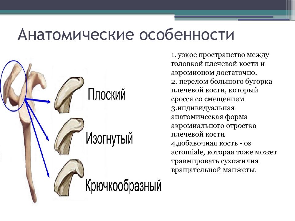 Перелом большого бугра плечевой кости