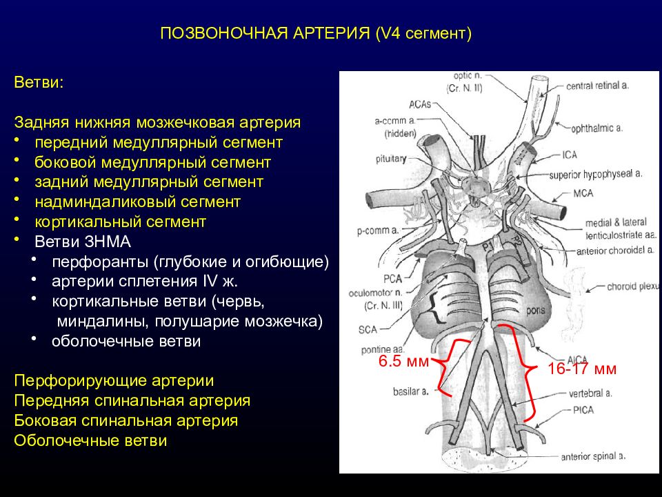 Сегменты позвоночной артерии. Сегменты v1 v2 позвоночных артерий. V4 сегмент позвоночной артерии. Интракраниальные сегменты позвоночных артерий. Задняя нижняя мозжечковая артерия на кт.