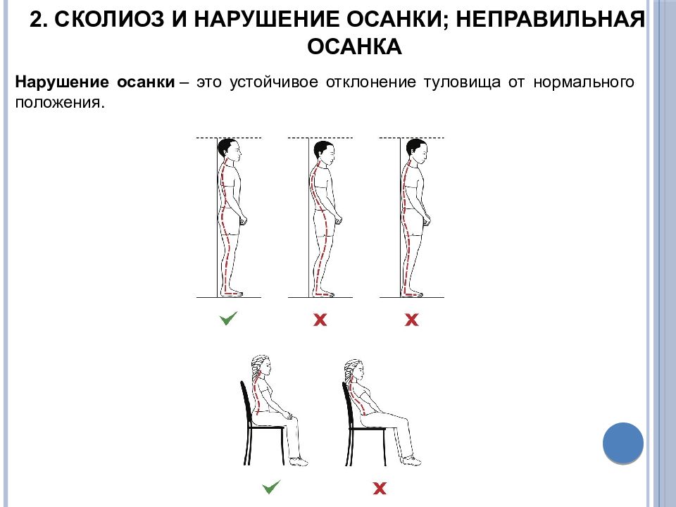 Главные нарушения осанки является. Методика выявления нарушения осанки. Факторы неправильной осанки. Профилактика искривления осанки. Причины формирования неправильной осанки.