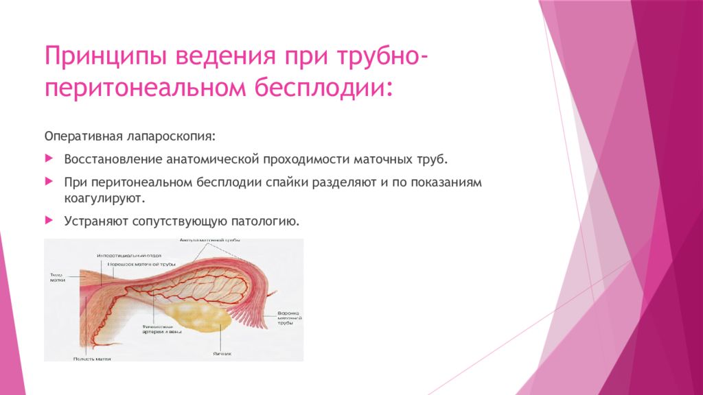 Перитонеальное бесплодие. Трубно-перитонеальное бесплодие. Трубное бесплодие причины. Вторичное бесплодие трубного генеза. Трубно-перитонеальное бесплодие лечение.