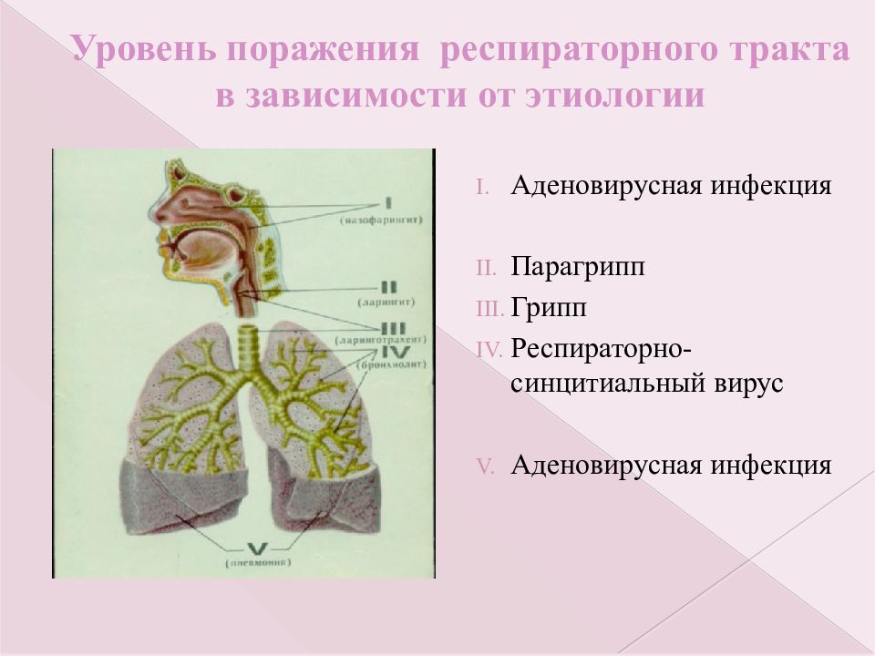 Уровень поражения. Грипп уровень поражения респираторного. Грипп уровень поражение респираторного тракта. Синдром поражения респираторного тракта. Уровень поражения респираторного тракта при гриппе.