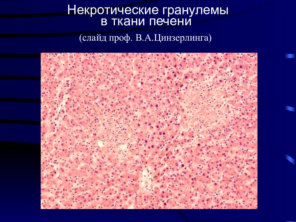 Кишечные инфекции патанатомия презентация