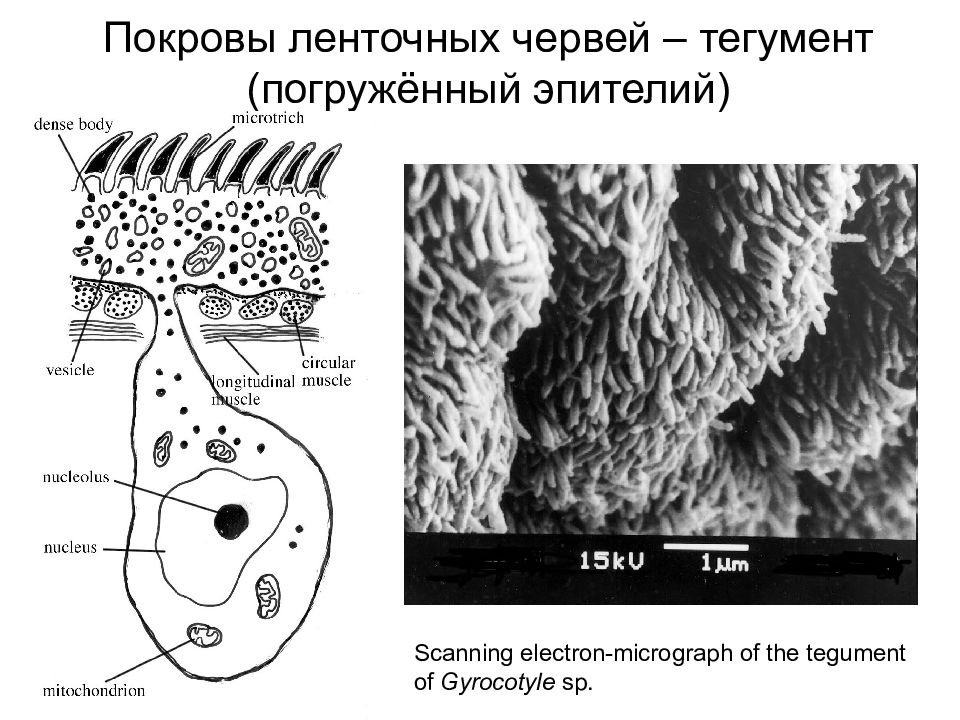 Тегумент ленточного червя рисунок с подписями