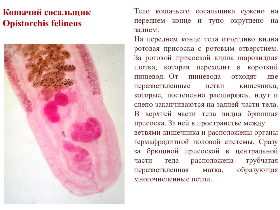 Заболевание вызванное сосальщиком