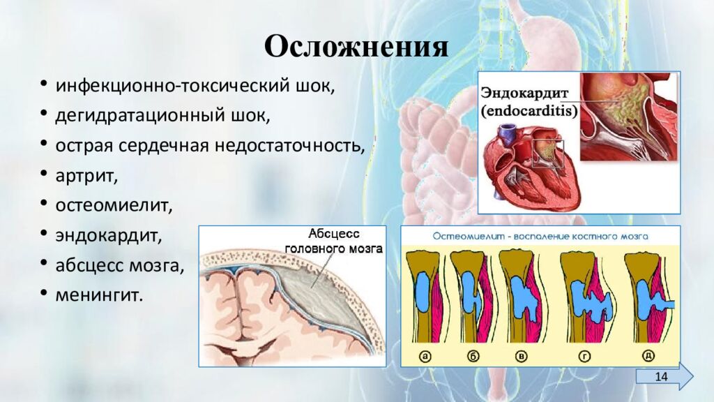 Осложнения