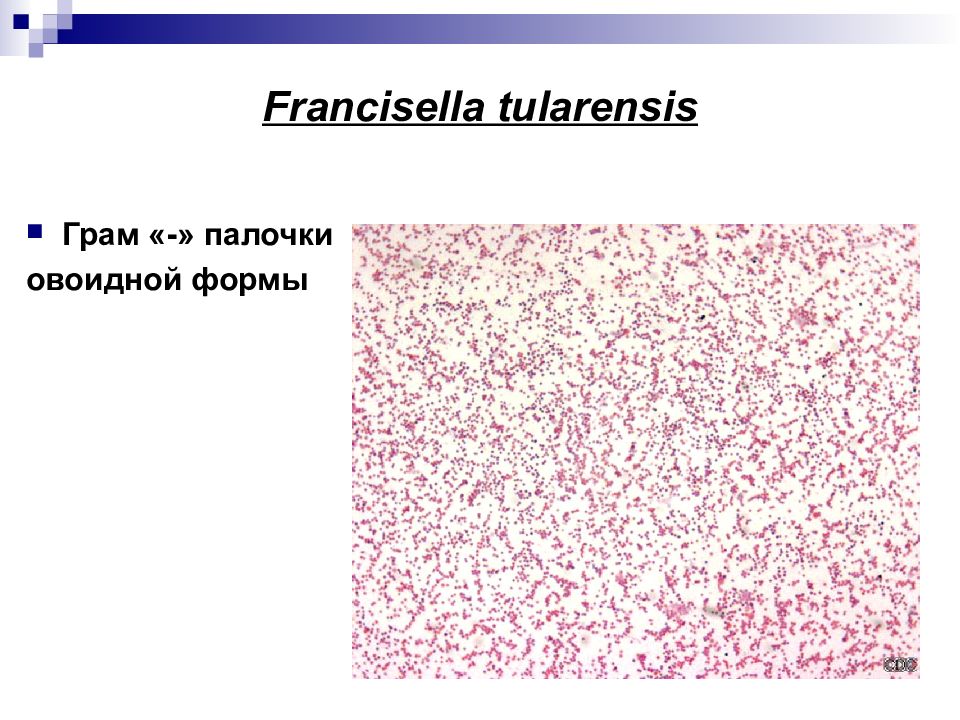 Возбудитель туляремии микробиология презентация