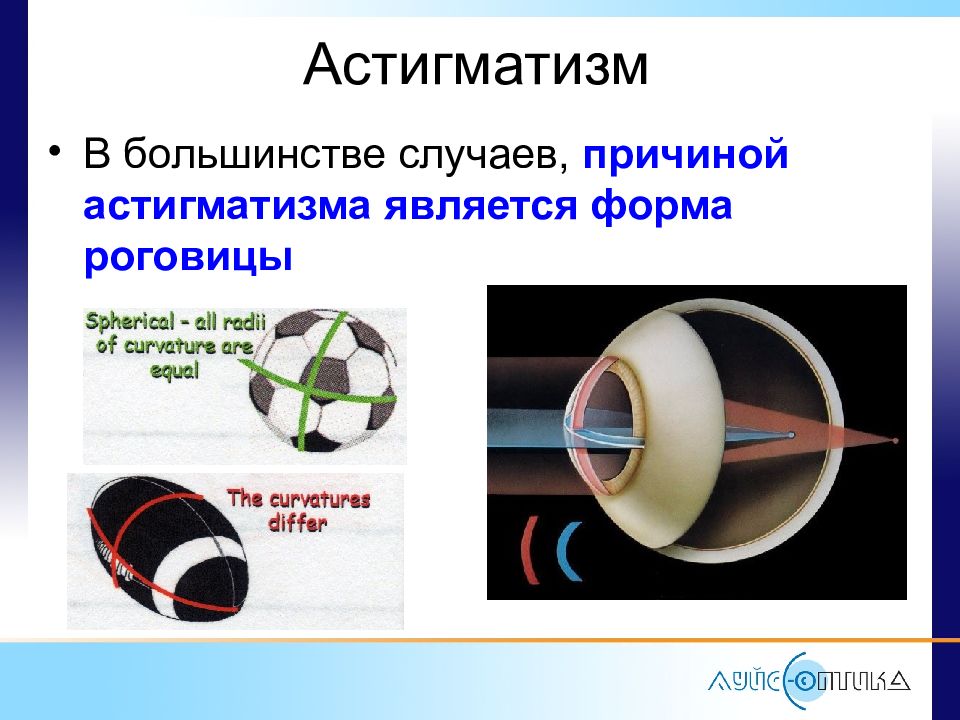 Астигматизм причины. Астигматизм это аметропия. Аметропия это в офтальмологии. Howell Test в оптометрии. К аметропии относятся.