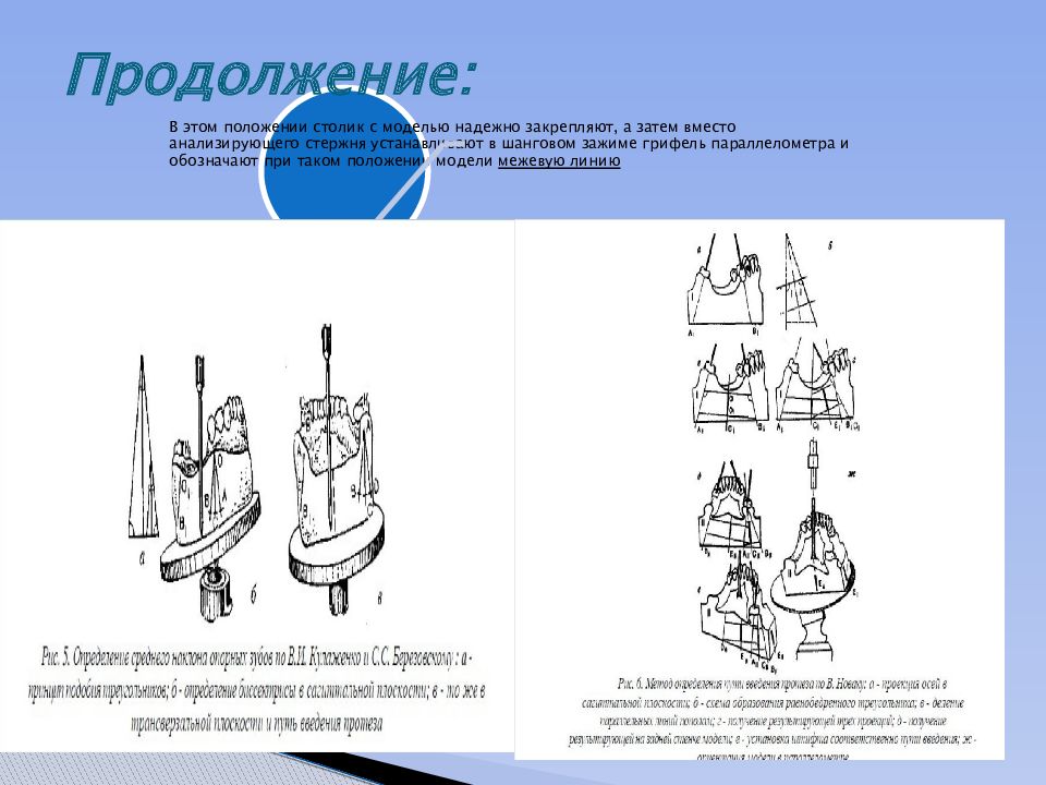 Параллелометрия в стоматологии презентация