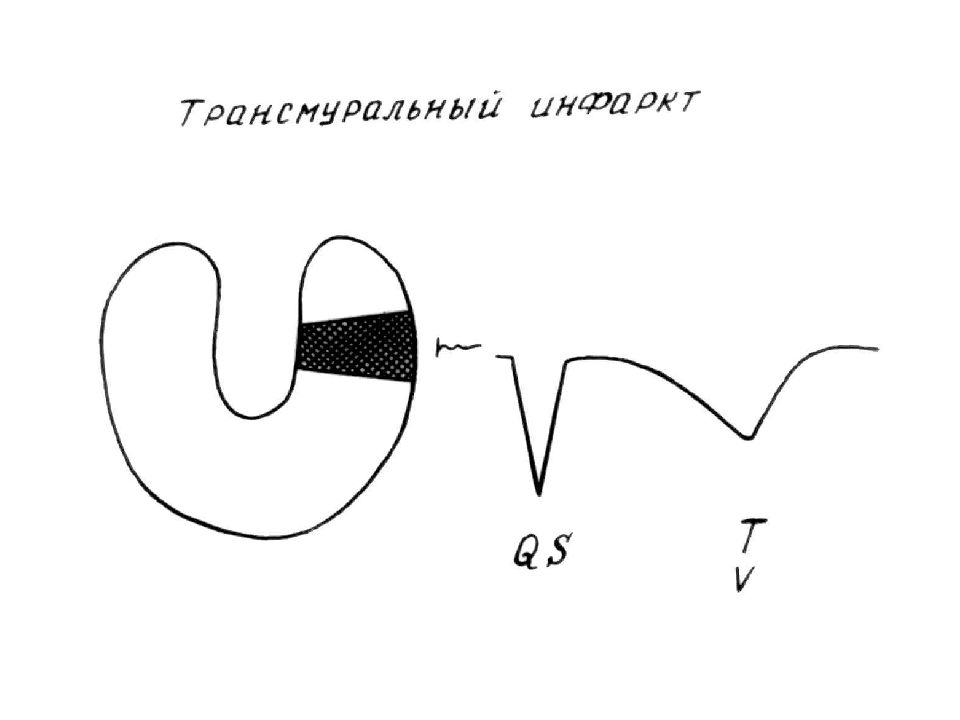 Экг пропедевтика