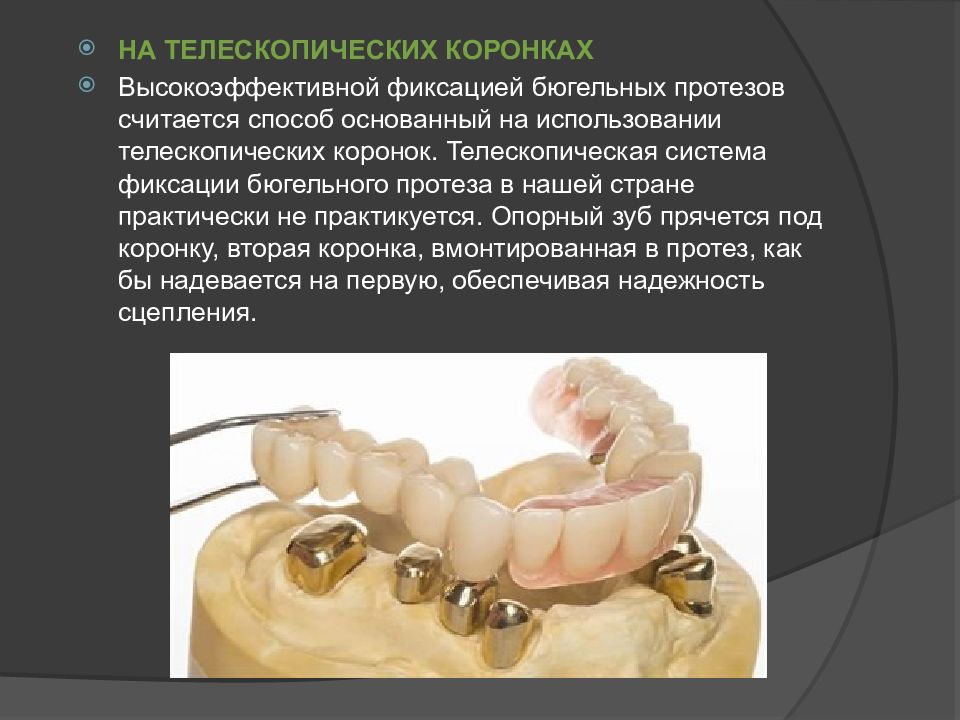 Бюгельное протезирование презентация