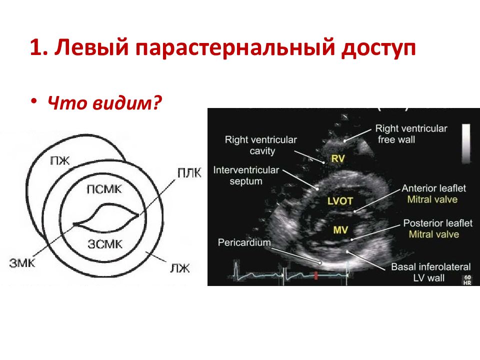 Сегменты сердца на узи схема