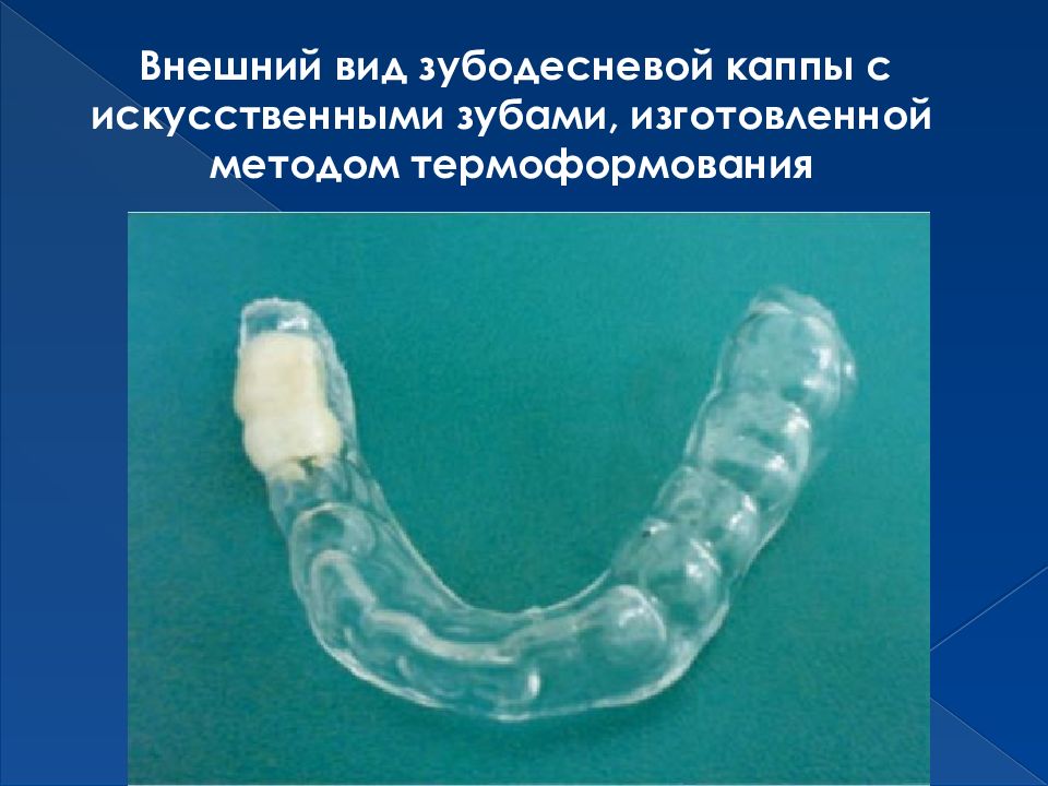 К Какому Стилю Относится Каппа