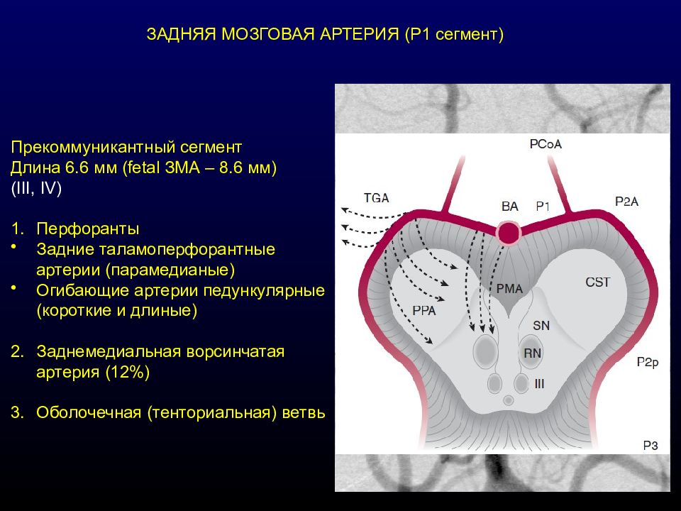 Сегмент артерии. Сегменты задней мозговой артерии. Сегменты зма анатомия. Сегменты артерий головного мозга. Задняя мозговая артерия анатомия сегменты.