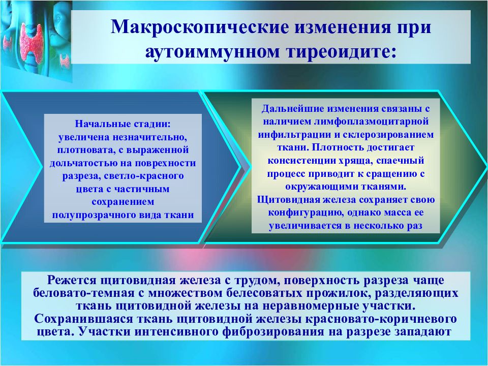 Диагностика заболеваний щитовидной железы презентация