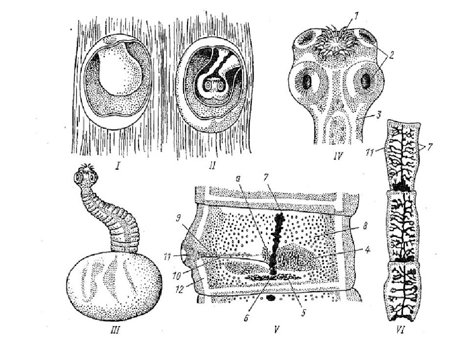 Сколексы цестод. Строение финны свиного цепня. Финна свиного цепня сколекс. Финна свиного цепня строение.