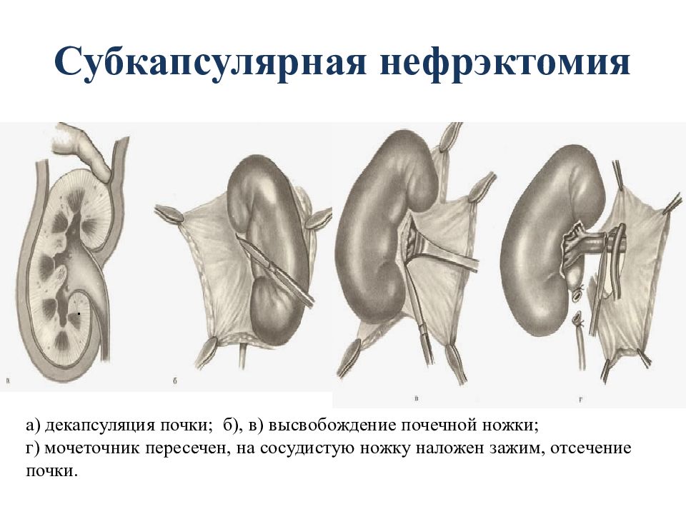 Почечная ножка