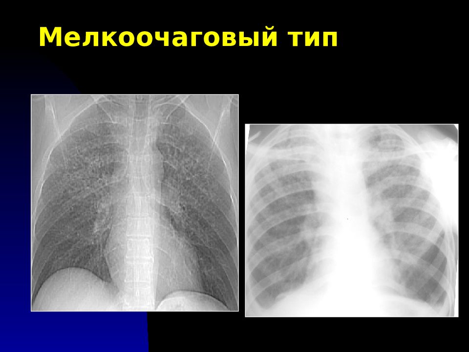 Лучевая диагностика органов дыхания презентация