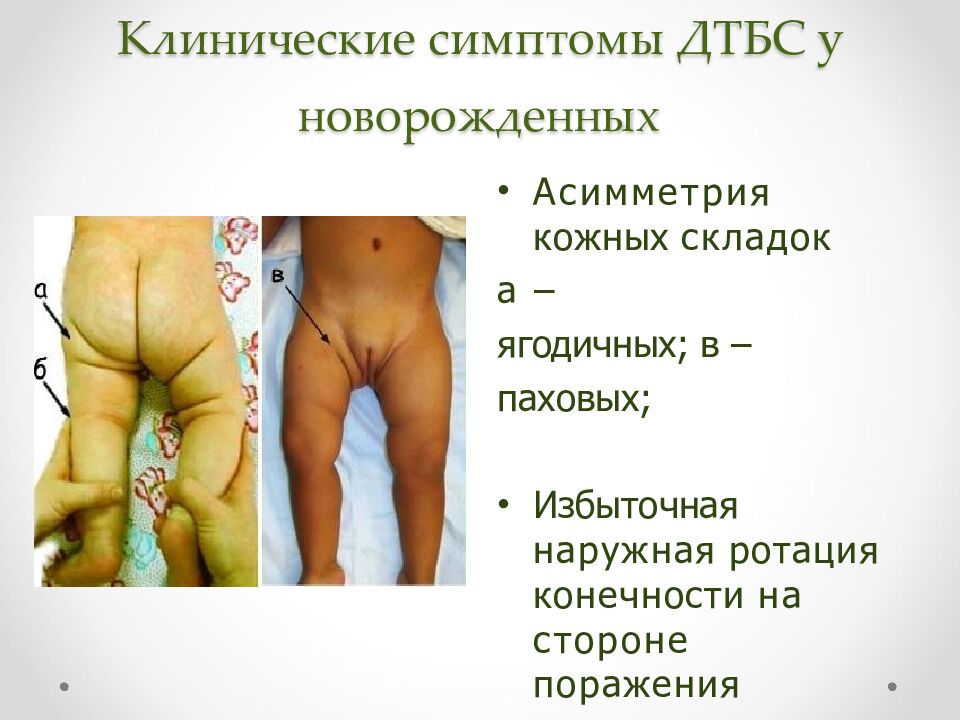 Клинические симптомы ДТБС у новорожденных