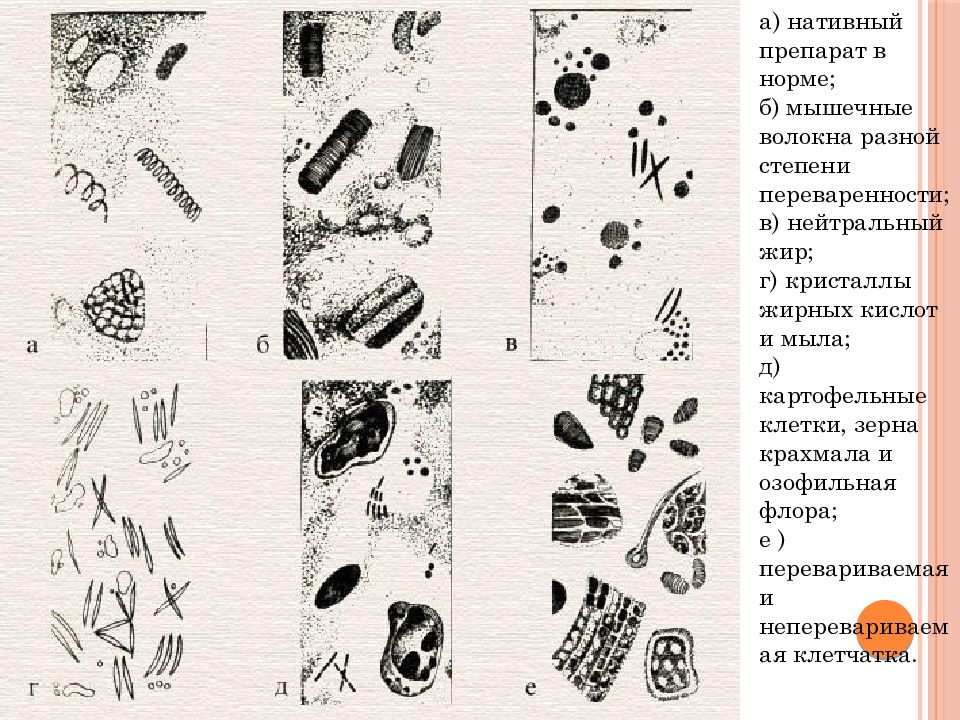 Микроскопия анализа кала