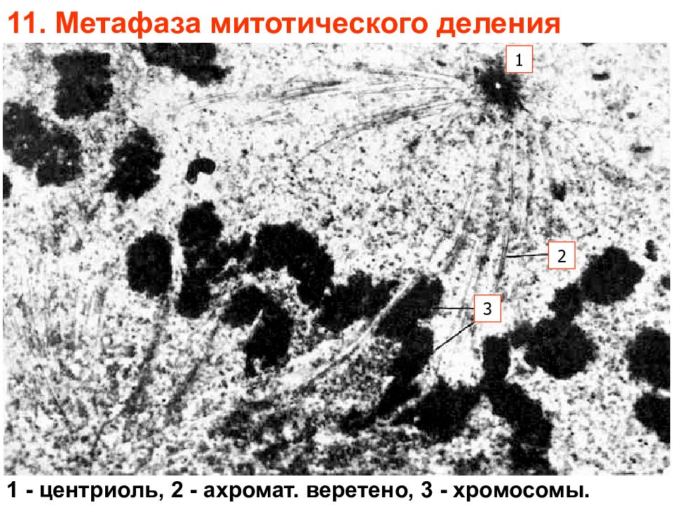 Центриоли хромосом. Веретено деления Электронограмма. Электронограмма хромосомы. Электронограмма центриоли. Митоз Электронограмма.