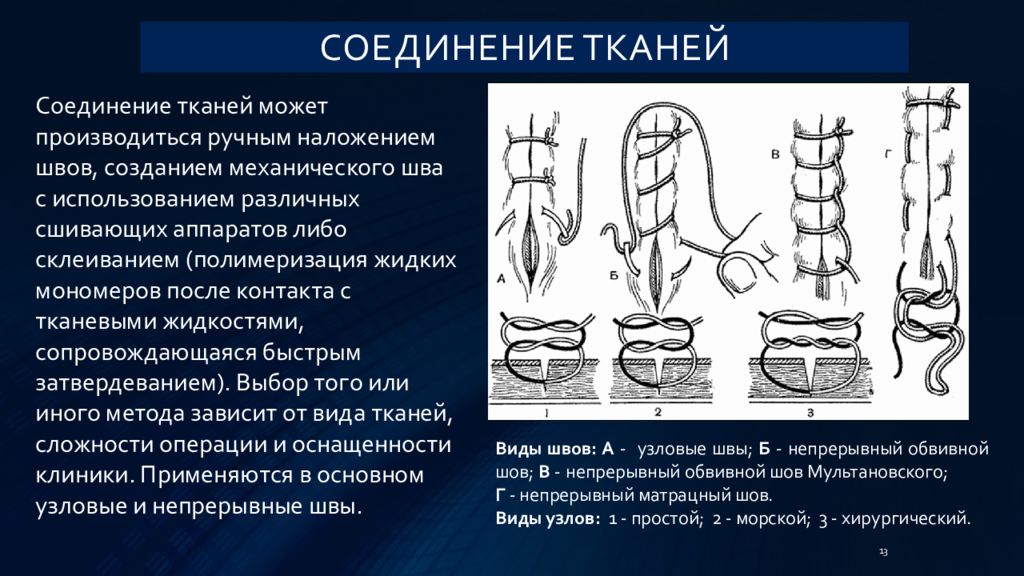 Соединение тканей. Непрерывный матрацный шов в хирургии. Обвивной матрацный шов. Шов Мультановского в хирургии. Матрацный шов в хирургии.