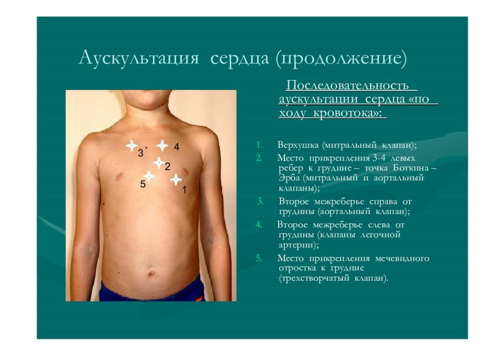 Сердечный порядок. Аускультация легких у новорожденных точки выслушивания. Аускультация сердца точки выслушивания у детей. Аускультация сердца у детей. Точки аускультации сердца у детей.