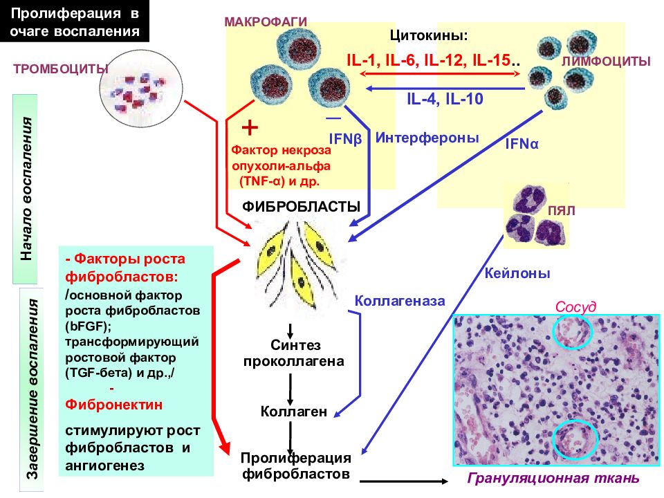 Патогенез воспаления схема