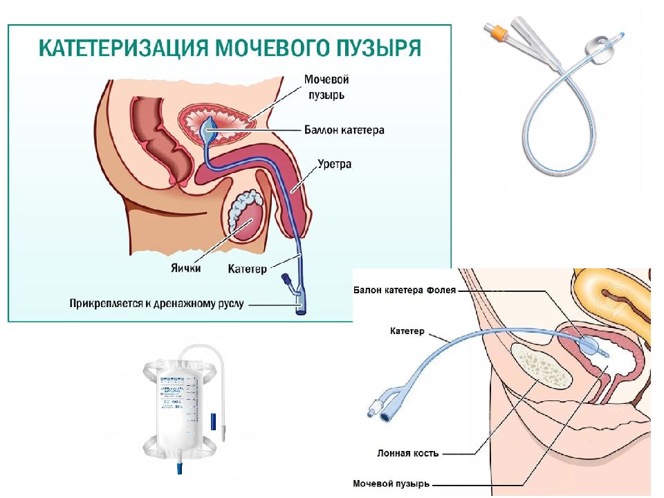 Инструментальные методы диагностики в урологии презентация