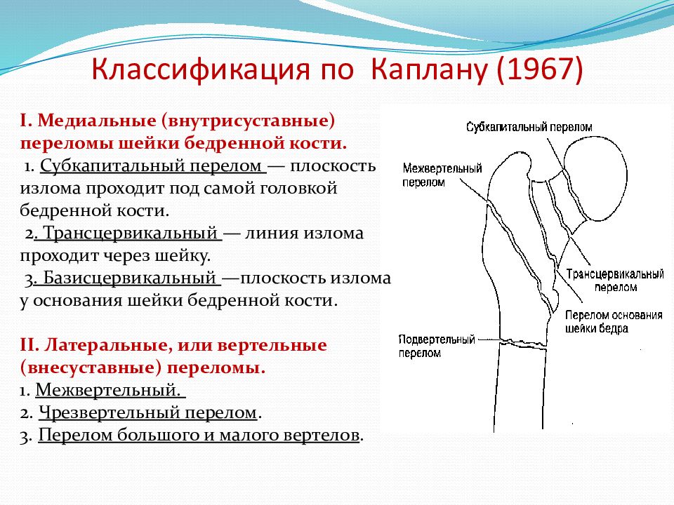 Повреждение бедренной кости. Переломы шейки(медиальные) бедренной кости. Классификация. Классификация переломов шейки бедренной кости. Шейка бедра перелом классификация. Чрезвертельный перелом шейки бедра классификация.