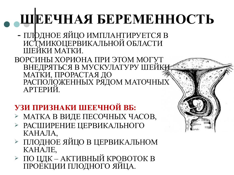 Острый живот при беременности презентация