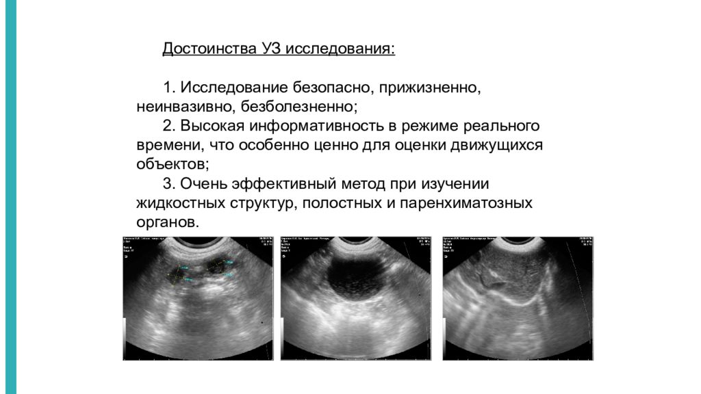 Узи презентация в медицине