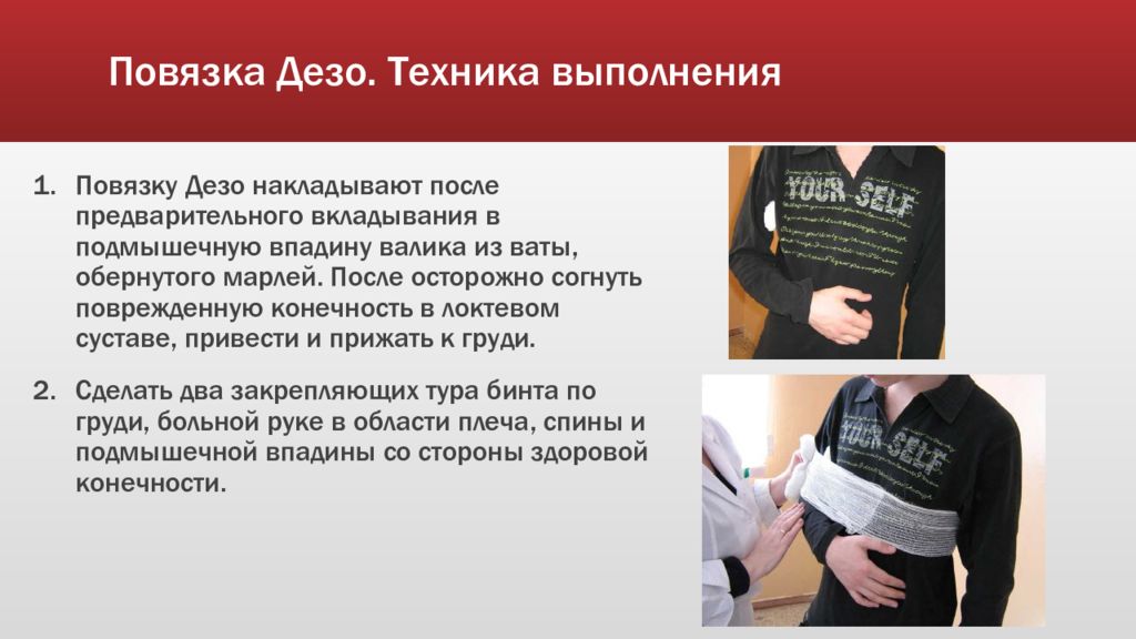 После предварительного. Наложение повязки Дезо алгоритм. Повязка Дезо техника. Повязка Дезо техника выполнения. Повязка Дезо алгоритм.