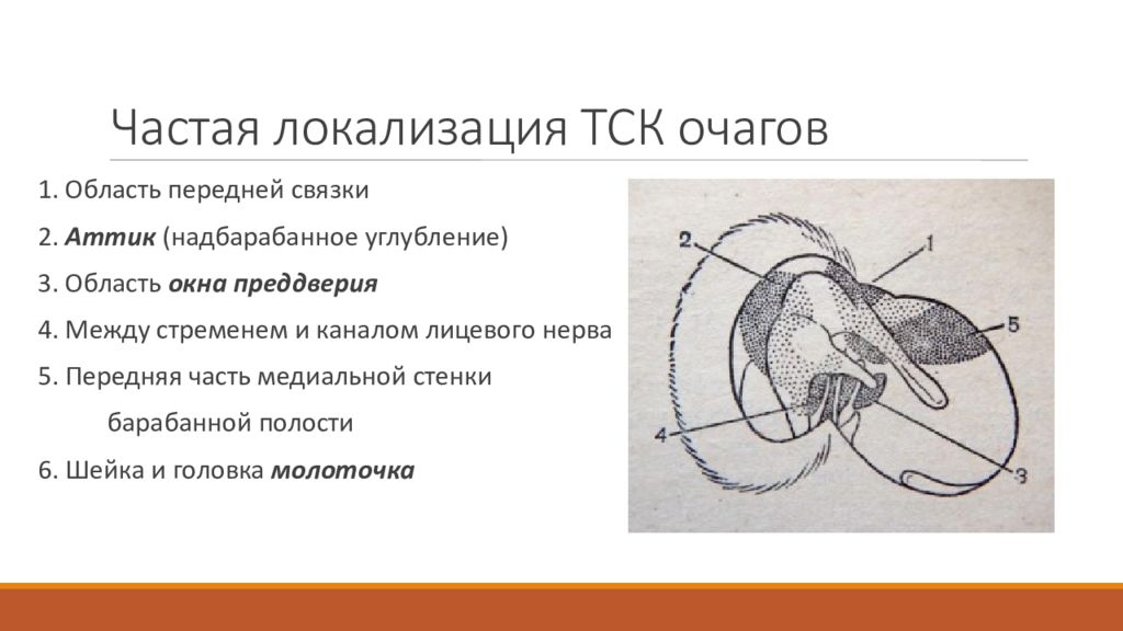 Частая локализация. Надбарабанное углубление. Головка молоточка и канал лицевого нерва. Локализация узловых очагов схема.