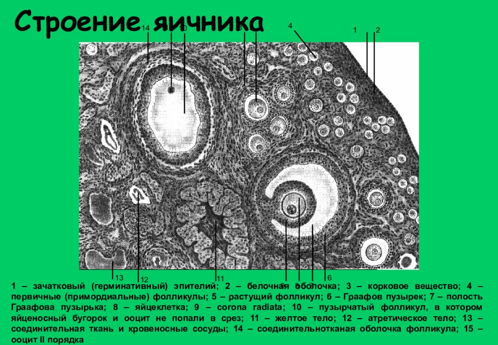 Клеточная полость. Граафов пузырек яичника строение. Граафов пузырек строение. Эпителий примордиального фолликула. Нарисуйте строение герминативного эпителия,.