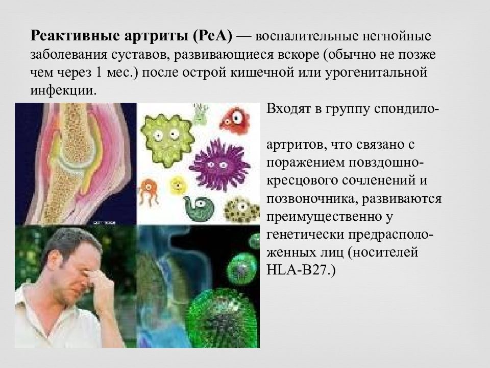 Реактивный артрит план обследования