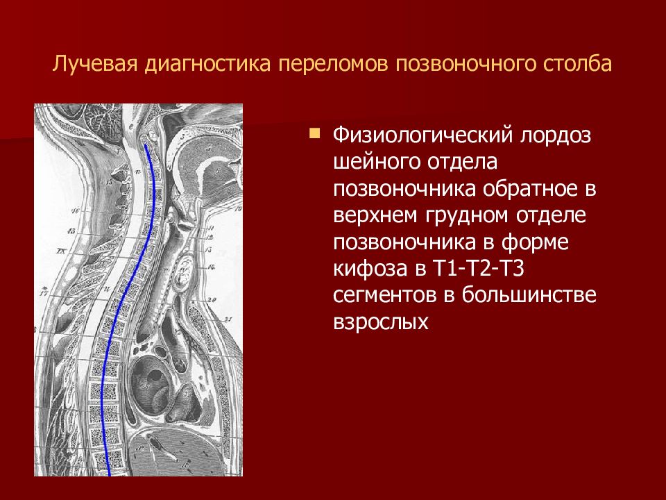 Презентации по лучевой диагностике