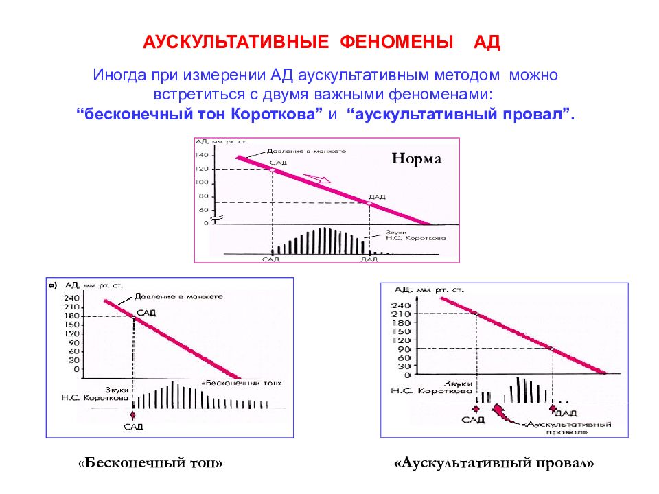 Аускультативная картина при открытом артериальном протоке характеризуется наличием